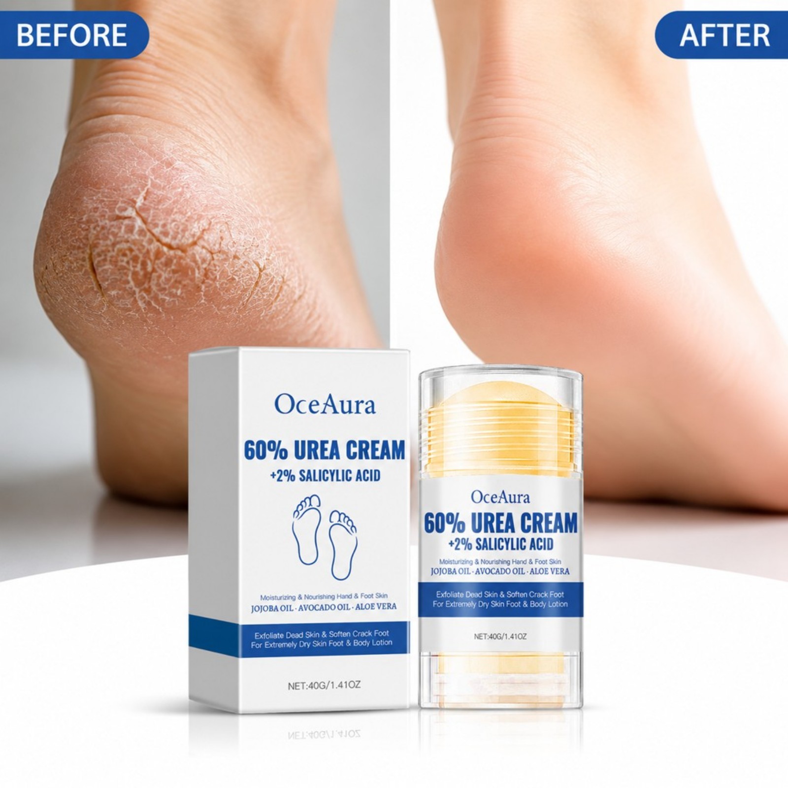 60% Urea Foot Care Cream Stick - огляд і ціна Urea Foot Cream
