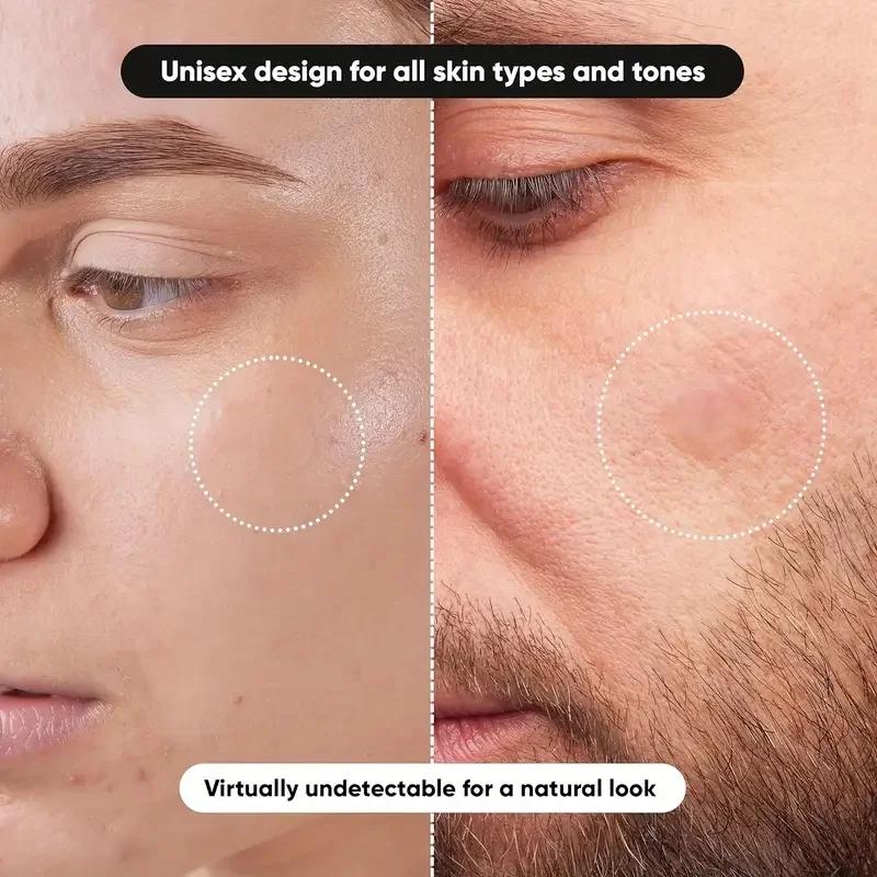 360 pieces/box acne patches -  - огляд і ціна Face Oil