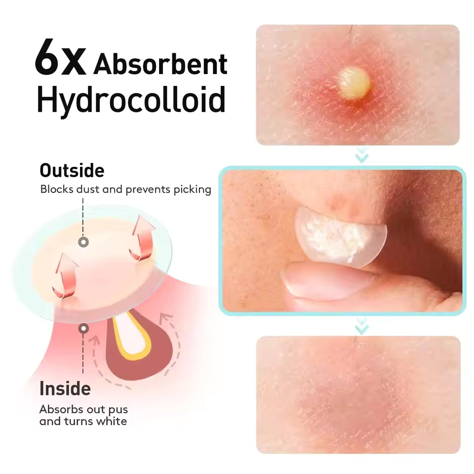 360 pieces/box acne patches -  - огляд і ціна Face Oil