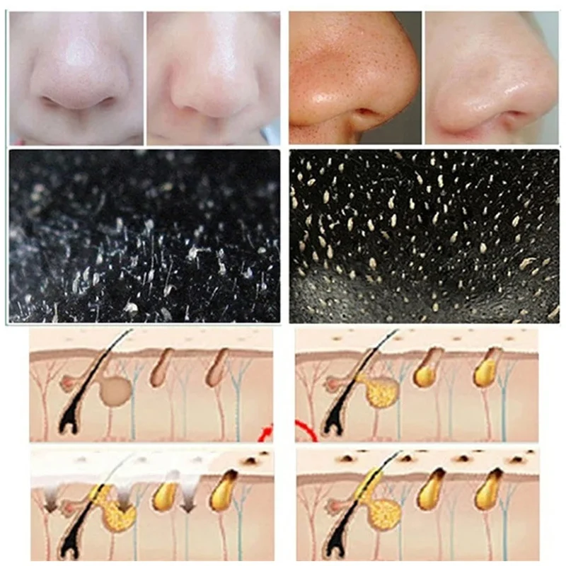 10pcs Blackhead Nose Strips De - огляд і ціна Cleanser Face