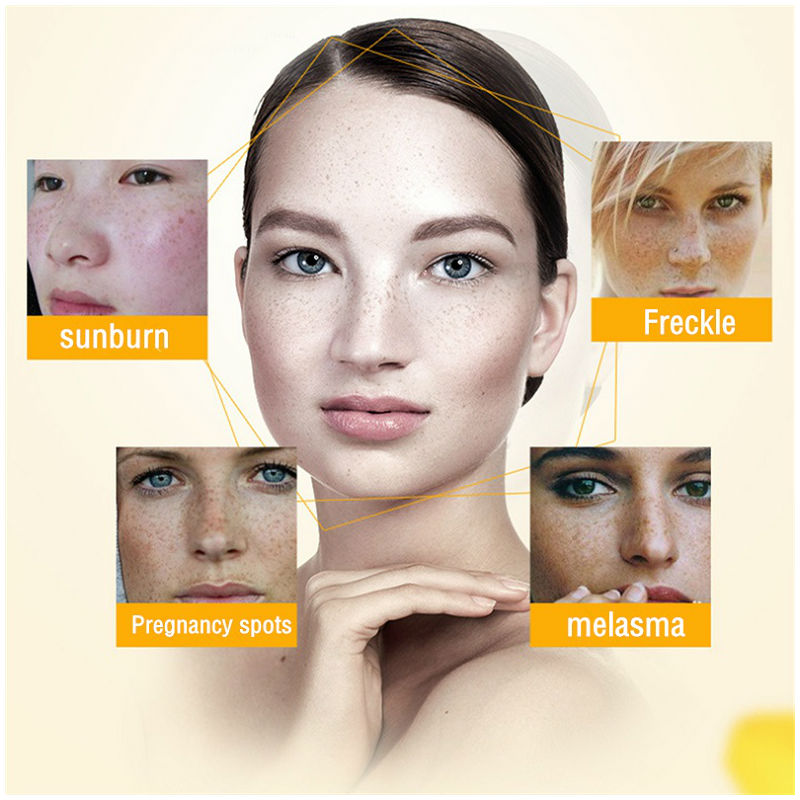 Dimollaure Whitening Freckle C - огляд і ціна Retinol Cream