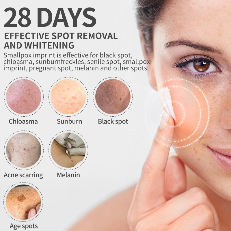 Dimollaure Whitening Freckle C - огляд і ціна Retinol Cream